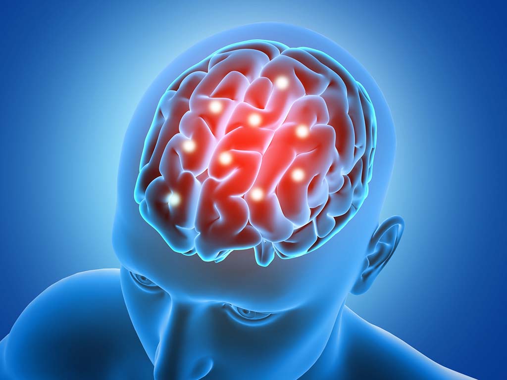 Brain.jpg